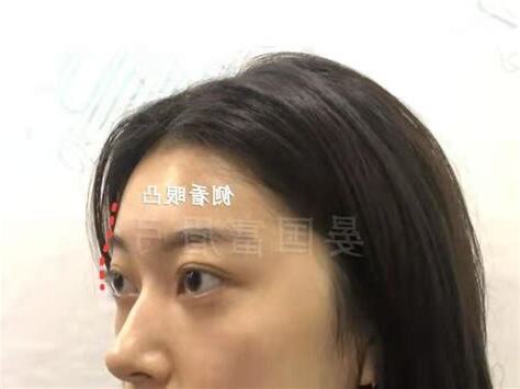 眼凸 面相